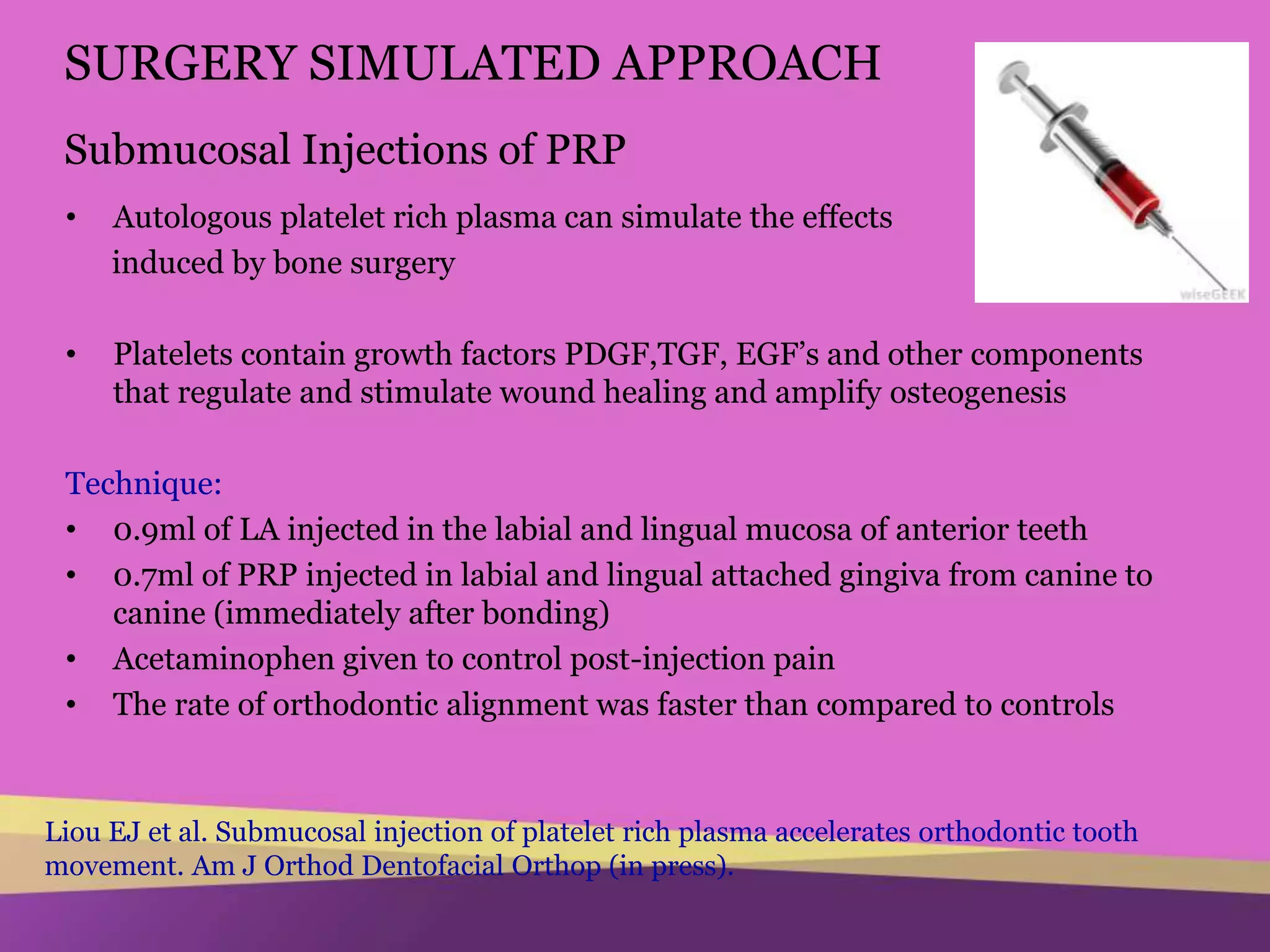 Accelerated orthodontic tooth movement | PPTX