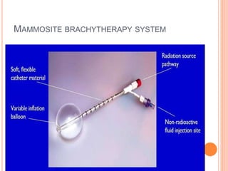 MAMMOSITE BRACHYTHERAPY SYSTEM
 