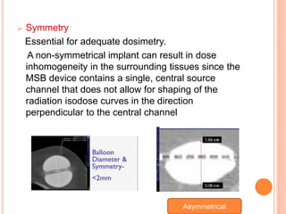  Symmetry
Essential for adequate dosimetry.
A non-symmetrical implant can result in dose
inhomogeneity in the surrounding tissues since the
MSB device contains a single, central source
channel that does not allow for shaping of the
radiation isodose curves in the direction
perpendicular to the central channel
Asymmetrical
 