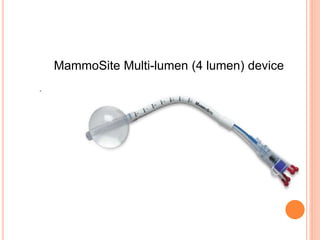 MammoSite Multi-lumen (4 lumen) device
 