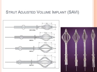 STRUT ADJUSTED VOLUME IMPLANT (SAVI)
 