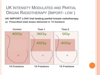 UK INTENSITY MODULATED AND PARTIAL
ORGAN RADIOTHERAPY (IMPORT- LOW )
 