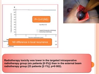 P= 0.41(NS)
N0 difference in local recurrence
Radiotherapy toxicity was lower in the targeted intraoperative
radiotherapy group (six patients [0·5%]) than in the external beam
radiotherapy group (23 patients [2·1%]; p=0·002).
 