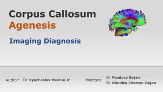 Disgenezia Corpului Calos
Corpus Callosum
Agenesis
Imaging Diagnosis
Author: Mentors:
Dr Rhodica Chertan-Bejan
Dr Vyacheslav Moshin Jr
Dr Feodosy Bejan
 