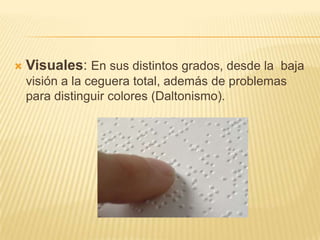Motrices: Dificultad o la imposibilidad de usar las manos, incluidos temblores, lentitud muscular, etc., debido a enfermedades como el Parkinson, distrofia muscular, parálisis cerebral, amputaciones... 