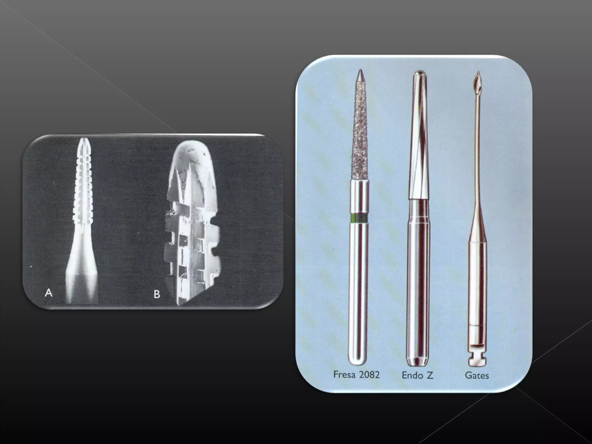 Acceso a la cavidad 2