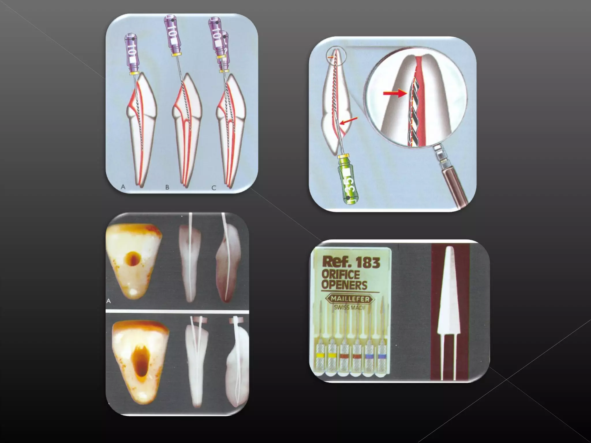 Acceso a la cavidad 2