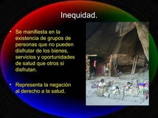 Inequidad.
• Se manifiesta en la
existencia de grupos de
personas que no pueden
disfrutar de los bienes,
servicios y oportunidades
de salud que otros si
disfrutan.
• Representa la negación
al derecho a la salud.
 