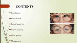 CONTENTS
Introduction
Classification
Etiopathogenesis
Clinical features
Investigation
Management
 