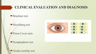 CLINICAL EVALUATION AND DIAGNOSIS
Bruckner test
Hirschberg test
Prism Cover tests
Synaptophore test
Ocular motility test
 