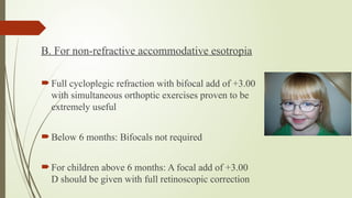 B. For non-refractive accommodative esotropia
 Full cycloplegic refraction with bifocal add of +3.00
with simultaneous orthoptic exercises proven to be
extremely useful
 Below 6 months: Bifocals not required
 For children above 6 months: A focal add of +3.00
D should be given with full retinoscopic correction
 