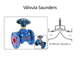Válvula Saunders
 