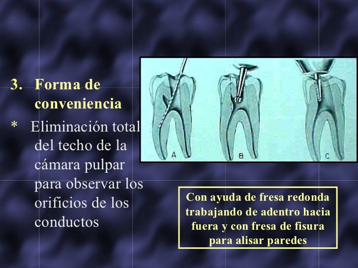Accesos