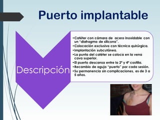 Puerto implantable
 
