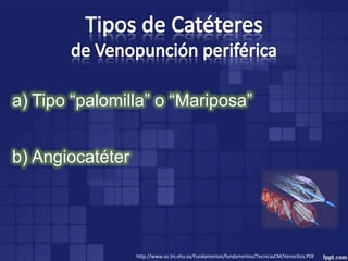 a) Tipo “palomilla” o “Mariposa”


b) Angiocatéter




                  http://www.oc.lm.ehu.es/Fundamentos/fundamentos/TecnicasCM/Venoclisis.PDF
 