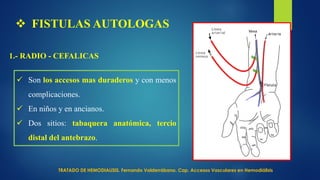  FISTULAS AUTOLOGAS
1.- RADIO - CEFALICAS
 Son los accesos mas duraderos y con menos
complicaciones.
 En niños y en ancianos.
 Dos sitios: tabaquera anatómica, tercio
distal del antebrazo.
TRATADO DE HEMODIALISIS. Fernando Valderrábano. Cap. Accesos Vasculares en Hemodiálisis
 