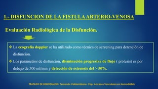 Evaluación Radiológica de la Disfunción.
 La ecografía doppler se ha utilizado como técnica de screening para detención de
disfunción.
 Los parámetros de disfunción, disminución progresiva de flujo ( prótesis) es por
debajo de 500 ml/min y detección de estenosis del > 50%.
1.- DISFUNCION DE LA FISTULAARTERIO-VENOSA
TRATADO DE HEMODIALISIS. Fernando Valderrábano. Cap. Accesos Vasculares en Hemodiálisis
 