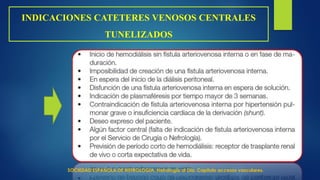 INDICACIONES CATETERES VENOSOS CENTRALES
TUNELIZADOS
SOCIEDAD ESPAÑOLA DE NEFROLOGIA. Nefrología al Día. Capitulo accesos vasculares.
 