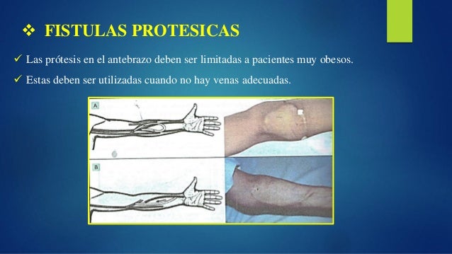Xeromorfia Plantas Xeromrficas Biologia Infoescola Xeromorfia Plantas Xeromrficas Biologia Infoescola