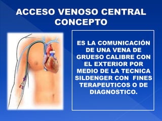 ES LA COMUNICACIÓN
DE UNA VENA DE
GRUESO CALIBRE CON
EL EXTERIOR POR
MEDIO DE LA TECNICA
SILDENGER CON FINES
TERAPEUTICOS O DE
DIAGNOSTICO.
 