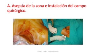 A. Asepsia de la zona e instalación del campo
quirúrgico.
Bugedo G, Castillo L. Cateterización venosa
 