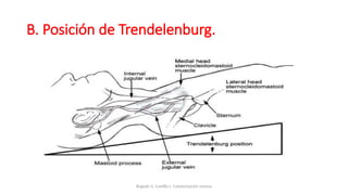 B. Posición de Trendelenburg.
Bugedo G, Castillo L. Cateterización venosa
 