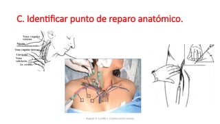 C. Identificar punto de reparo anatómico.
Bugedo G, Castillo L. Cateterización venosa
 