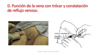 D. Punción de la vena con trócar y constatación
de reflujo venoso.
Bugedo G, Castillo L. Cateterización venosa
 