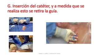 G. Inserción del catéter, y a medida que se
realiza esto se retira la guía.
Bugedo G, Castillo L. Cateterización venosa
 