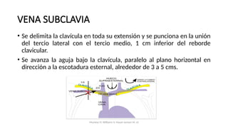• Se delimita la clavícula en toda su extensión y se punciona en la unión
del tercio lateral con el tercio medio, 1 cm inferior del reborde
clavicular.
• Se avanza la aguja bajo la clavícula, paralelo al plano horizontal en
dirección a la escotadura esternal, alrededor de 3 a 5 cms.
VENA SUBCLAVIA
Mumtaz H, Williams V, Hauer-Jensen M, et
 