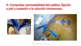 H. Comprobar permeabilidad del catéter, fijación
a piel y conexión a la solución intravenosa.
Bugedo G, Castillo L. Cateterización venosa
 