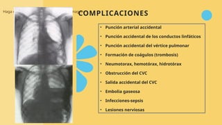 COMPLICACIONES
Haga clic en el icono para agregar una imagen
• Punción arterial accidental
• Punción accidental de los conductos linfáticos
• Punción accidental del vértice pulmonar
• Formación de coágulos (trombosis)
• Neumotorax, hemotórax, hidrotórax
• Obstrucción del CVC
• Salida accidental del CVC
• Embolia gaseosa
• Infecciones-sepsis
• Lesiones nerviosas
 