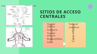 SITIOS DE ACCESO
CENTRALES
Cava
superior
Yugular
interna
Subclavia
Yugular
externa
Braquicefalica
Axilar
Cava
inferior
Femoral
Umbilical
Haga clic en el icono para agregar una imagen
 