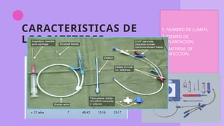 CARACTERISTICAS DE
LOS CATETERES
1. NUMERO DE LUMEN.
2. TIEMPO DE
IMPLANTACION.
3. MATERIAL DE
CONFECCION.
 