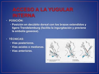 • POSICIÓN:
• Posición en decúbito dorsal con los brazos extendidos y
ligero Trendelemburg (facilita la ingurgitación y previene
la embolia gaseosa).
• TÉCNICAS:
• Vías posteriores.
• Vías axiales o medianas.
• Vías anteriores.
 
