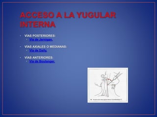 • VÍAS POSTERIORES:
• Vía de Jernigan.
• VÍAS AXIALES O MEDIANAS:
• Vía de Daily.
• VÍAS ANTERIORES:
• Vía de Boulanger.
 