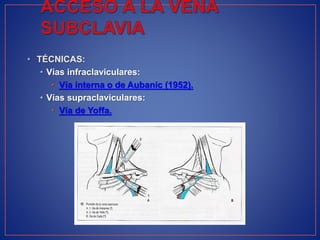 • TÉCNICAS:
• Vías infraclaviculares:
• Vía interna o de Aubanic (1952).
• Vías supraclaviculares:
• Vía de Yoffa.
 