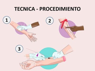TECNICA - PROCEDIMIENTO
1
3
2
 