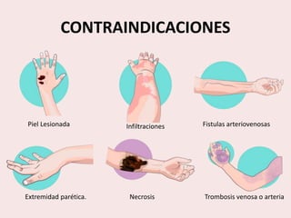 CONTRAINDICACIONES
Piel Lesionada Fistulas arteriovenosas
Trombosis venosa o arteriaExtremidad parética.
Infiltraciones
Necrosis
 