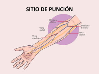 SITIO DE PUNCIÓN
 