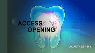 z
ACCESS
OPENING
ANANTHESH H S
 