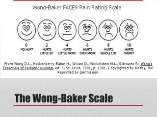 The Wong-Baker Scale
 