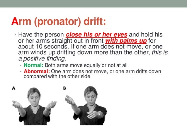 20 Inspirasi Populer Arm Motor Drift 20 Inspirasi Populer Arm Motor Drift