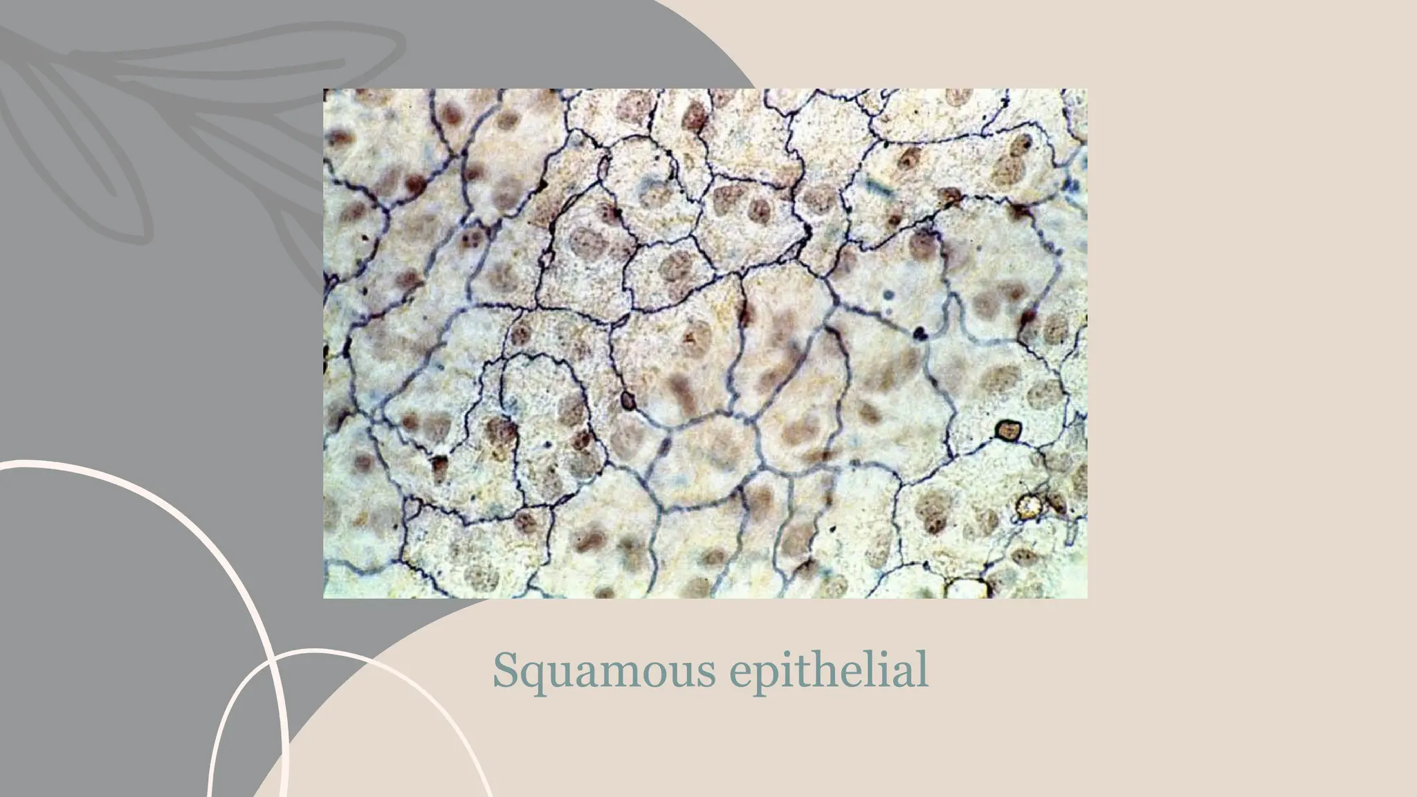 Squamous epithelial
 