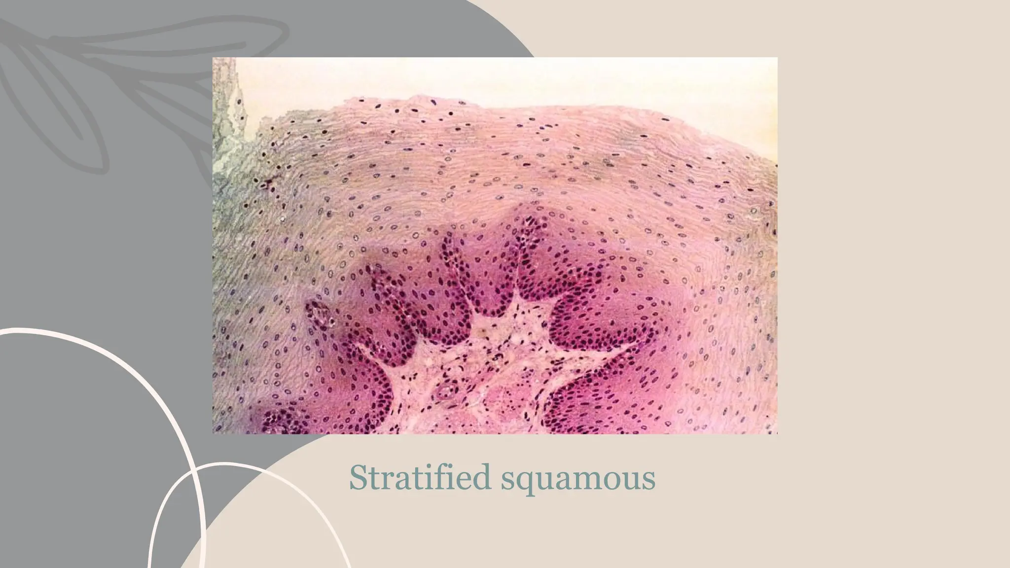 Stratified squamous
 