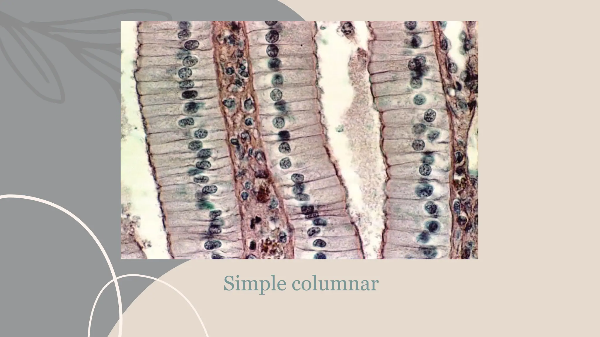Simple columnar
 