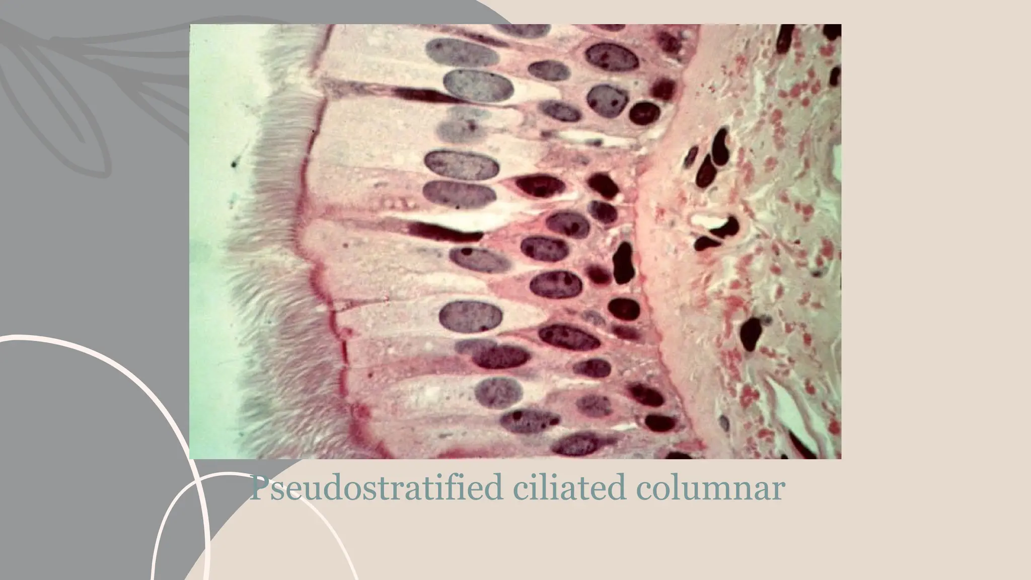 Pseudostratified ciliated columnar
 