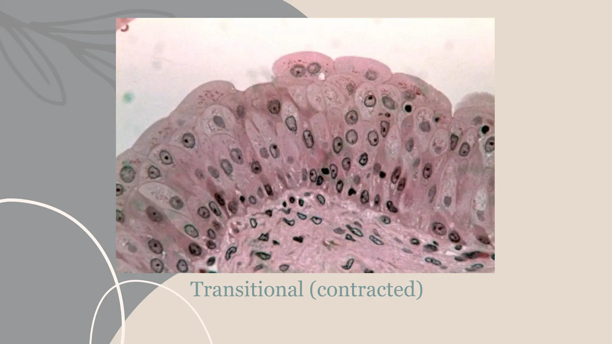 Transitional (contracted)
 