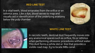 RED LINETEST
In a vital teeth, blood emanates from the orifice or an
isthmus area. Like a dye, blood serves to map and
visually aid in identification of the underlying anatomy
below the pulp chamber
WHITE LINETEST
In necrotic teeth, dentinal dust frequently moves into
any anatomical spaces such as orifice, fin or isthmus
when performing ultrasonic procedures without water
This dust forms a white dot or line that provides a
visible road map. Eg to locate MB2 canal.
15
 