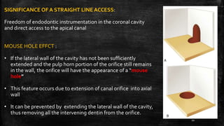 SIGNIFICANCE OF A STRAIGHT LINE ACCESS:
Freedom of endodontic instrumentation in the coronal cavity
and direct access to the apical canal
MOUSE HOLE EFFCT :
• If the lateral wall of the cavity has not been sufficiently
extended and the pulp horn portion of the orifice still remains
in the wall, the orifice will have the appearance of a “mouse
hole”
• This feature occurs due to extension of canal orifice into axial
wall
• It can be prevented by extending the lateral wall of the cavity,
thus removing all the intervening dentin from the orifice.
20
 